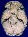 Vue inférieure du cerveau humain, les gyri orbitaires ne sont pas légendés mais visibles en haut.