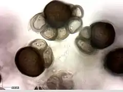 Boules de spores d'Urocystis anemones.