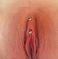 Piercing vertical du capuchon du clitoris.