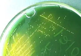 Colonies jaunes (fermentant du saccharose) de V. cholerae sur gélose TCBS.