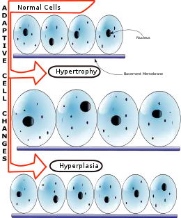 Description de l'image Hyperplasia vs Hypertrophy.svg.