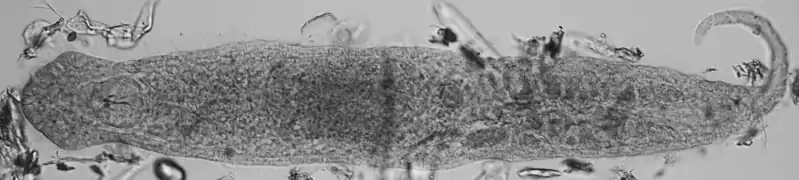 Gnathostomula paradoxa (Gnathostomulida)