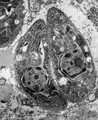 Toxoplasma gondii, microscopie électronique à transmission